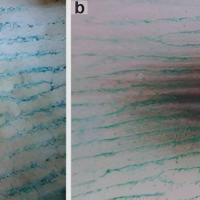 Ink test to help determine pattern - in the test…