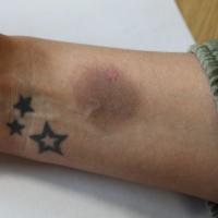 
	Same patient as previous image

	A FDE will…