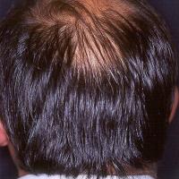 
	Same patient as figure 1