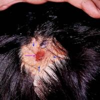 
	Naevus sebaceous and BCC
	The rate of…