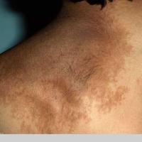 
	​Same patient as previous image