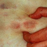 
	Same patient as previous image

	Copied with…