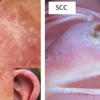 2 cases - CDNH vs SCCThe SCC was pointing…