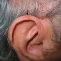 
	CDNH of helix