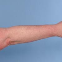 
	Same patient as previous image