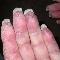 Same patient as previous image
