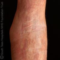 Same patient
Copied with kind permission from…