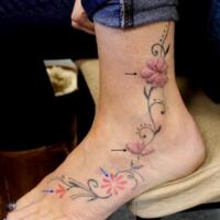  Allergic reaction to red tattoo dye The upper…