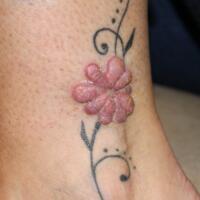  Same patient as previous image