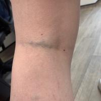 Same patient as previous image
Copied with kind…