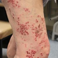 
	Same patient as previous image