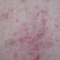 
	Same patient as previous image