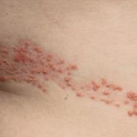 Same patient as previous image
Image copied with…