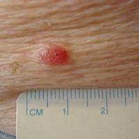 
	Close up of the lower BCC in figure 5

	Copied…