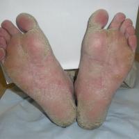 
	Same patient as previous image
