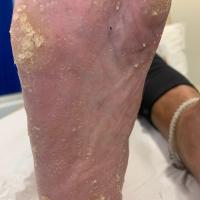 Same patient as previous figure
