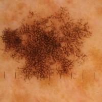Same lesion as previous figureOnce we examine…