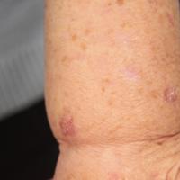 
	Same patient as previous image