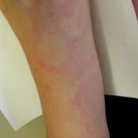 
	Same patient as previous image