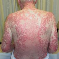 
	Same patient as previous image