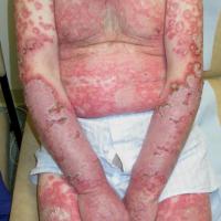 Same patient as previous image