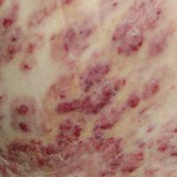 
	Close-up of previous image

	Copied with…