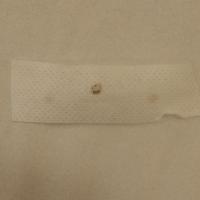 Same lesion - the appearance of the Hypafix after…