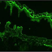 
	MMP

	Salt-split skin studies show localisation…