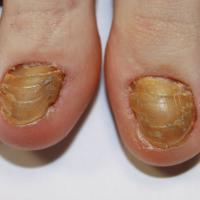 
	Same patient as previous image