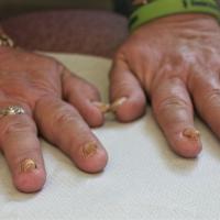 
	Pincer nails

	Images copyright of South…