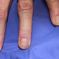 
	Same patient as previous image - transverse…