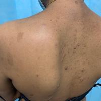 Same patient as previous image