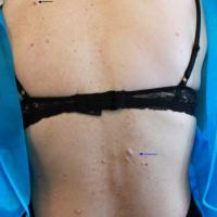 
	NF1

	Cutaneous neurofibromas (black arrows)…