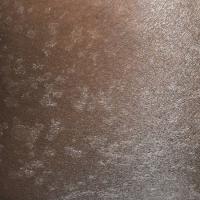 
	Pityriasis versicolor in skin of…