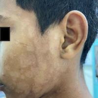 Same patient as previous image
Copied with kind…