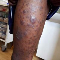 Same patient as previous image
Copied with kind…