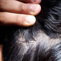 Same patient as previous figure - additional…