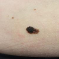 Clinical appearance of the previous…