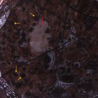Dermoscopic appearance of the larger lesion in…