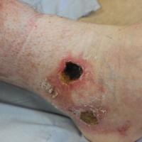 
	Same patient as previous image