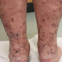 
	Same patient as previous image