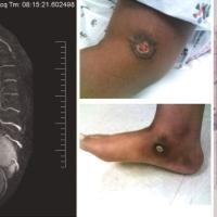 
	Takayasu&rsquo;s arteritis

	Magnetic resonance…