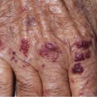 
	Same patient as previous image