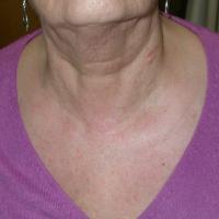 
	Same patient as previous image:&nbsp;…