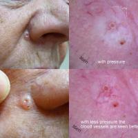 
	Effects of pressure&nbsp;