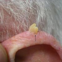Grade 3 actinic keratosis