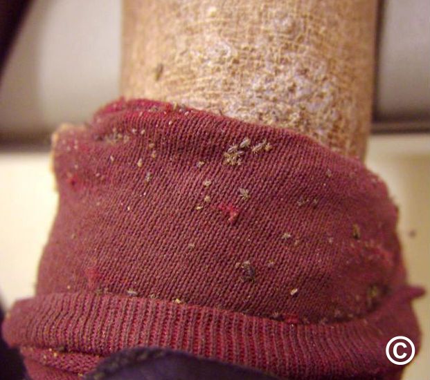 How Long Can Pubic Lice Live In Bedding Shop head.hesge.ch