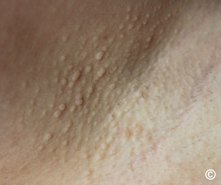 Porno yigit tik turgan holatda qin ichida cums Gozal qizning orgazmi onlayn