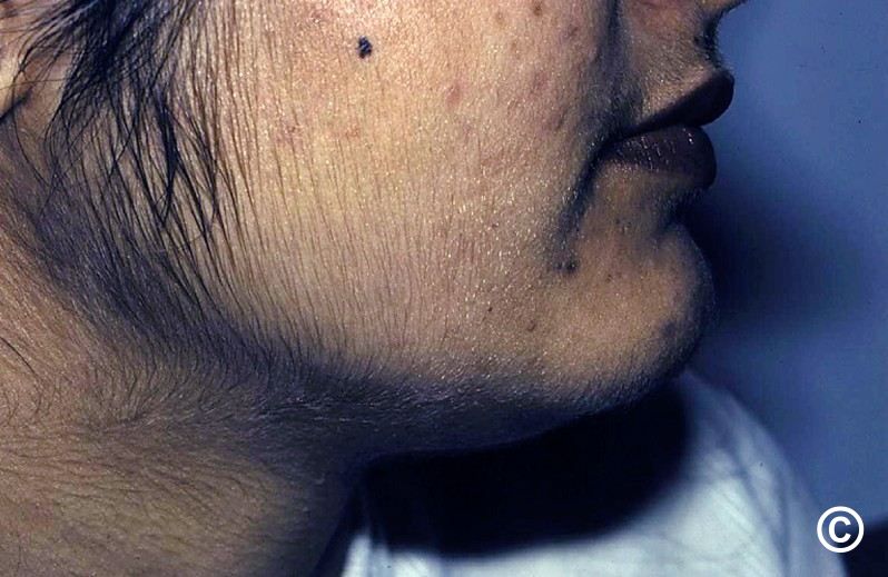Chin Hair Can Be Annoying—Here's How to Nip It in the Bud